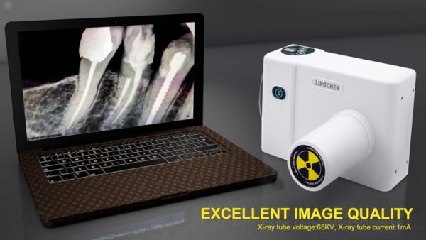 Portable Dental Xray Machine - Image 5